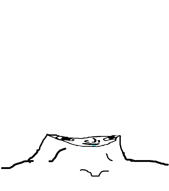 Brainlet flat head drooling — Brainlet meme