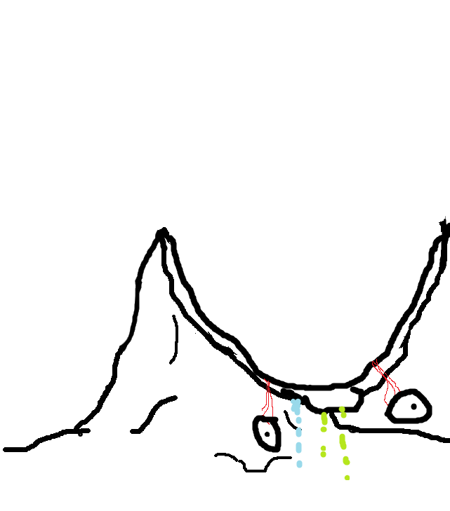 Brainlet bowl head — Brainlet meme